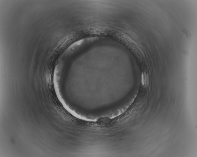 X0000111481155200908111155