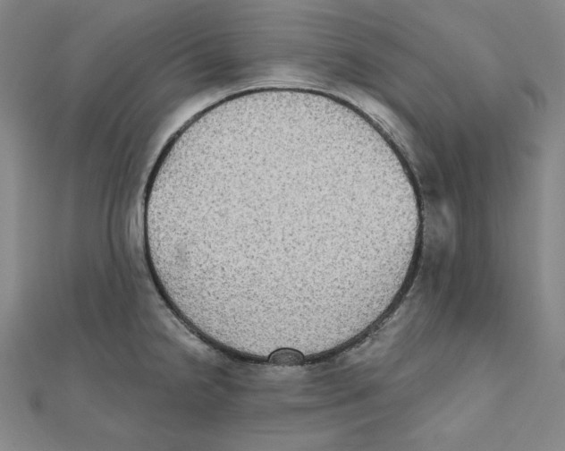 X0000111481238200908111154