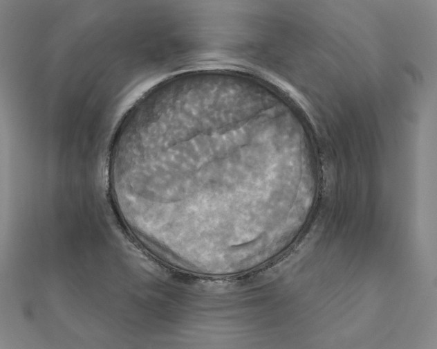 X0000111481415200908111151