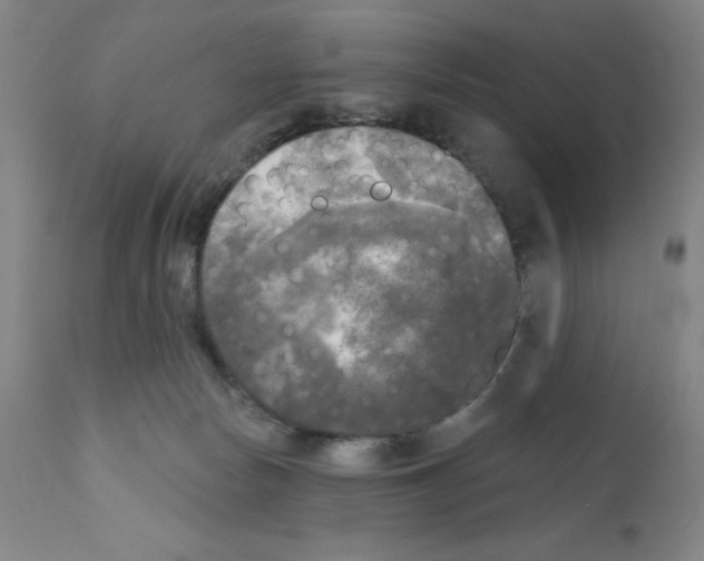 X0000111480178200908251010