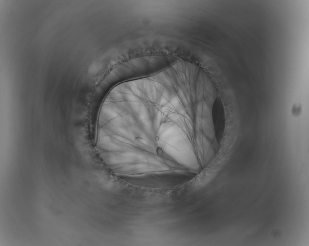 X0000111480192200908251010