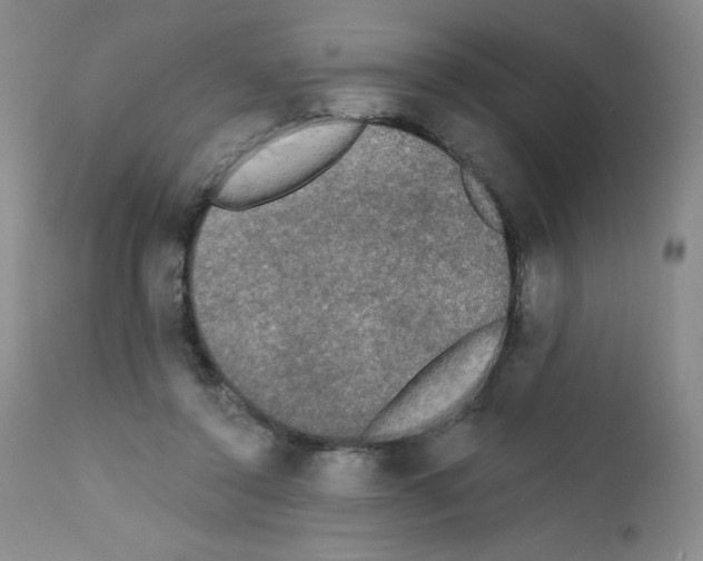 X0000111480356200908251007