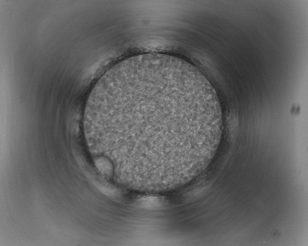 X0000111480499200908251005
