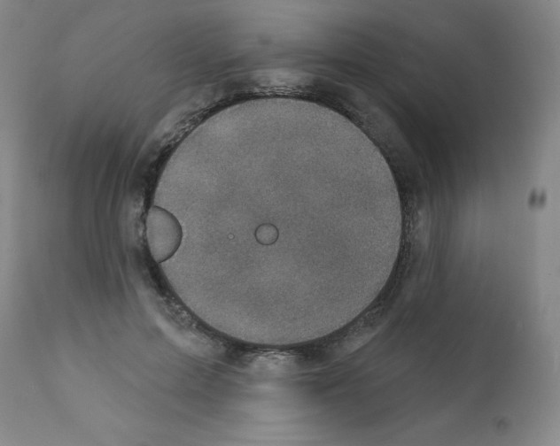X0000111480599200908251003