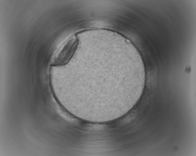 X0000111481039200908250957