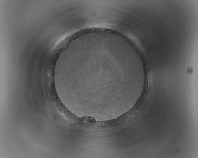 X0000111481064200908250956