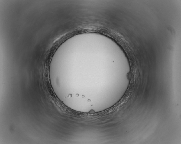 X0000111491158200907141057