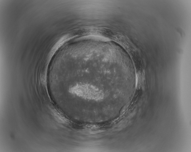 X0000111490195200907141245