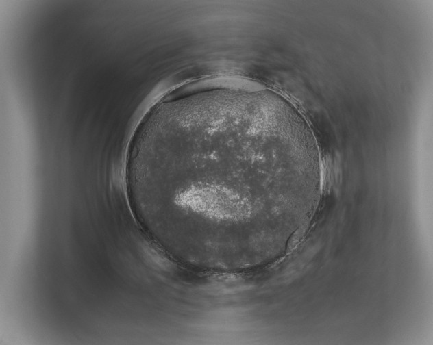 X0000111490195200907211016