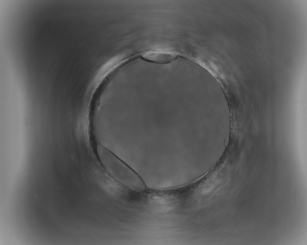 X0000111490199200907211016