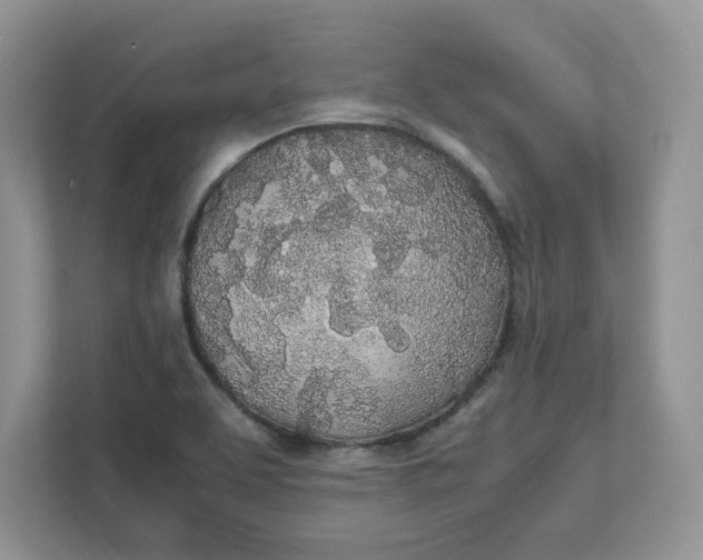 X0000111491463200908041132