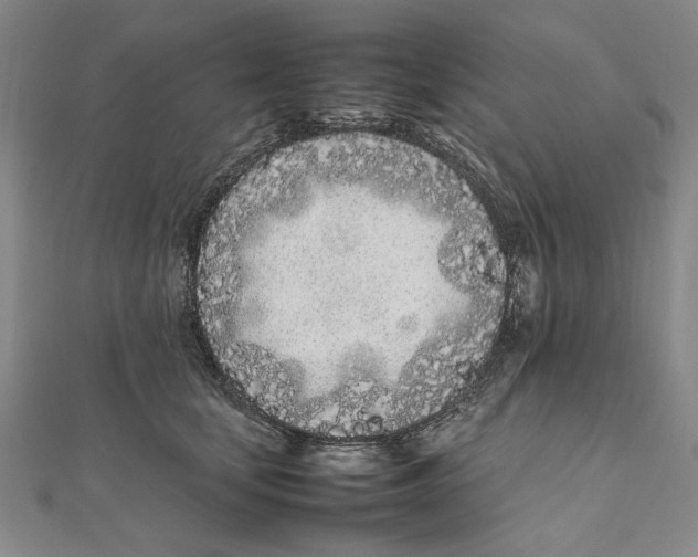 X0000111490659200908111225