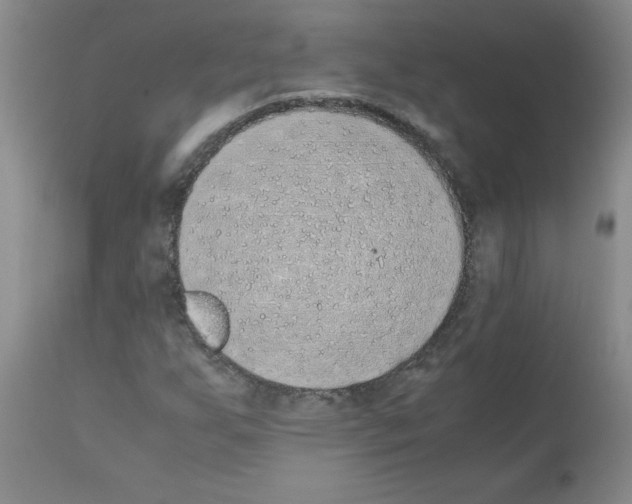 X0000111491255200908251017