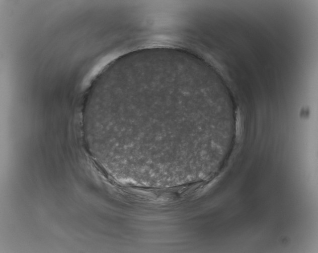 X0000111491453200908251014