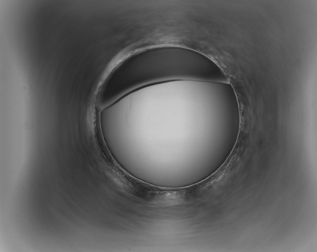 X0000111500056200907141052