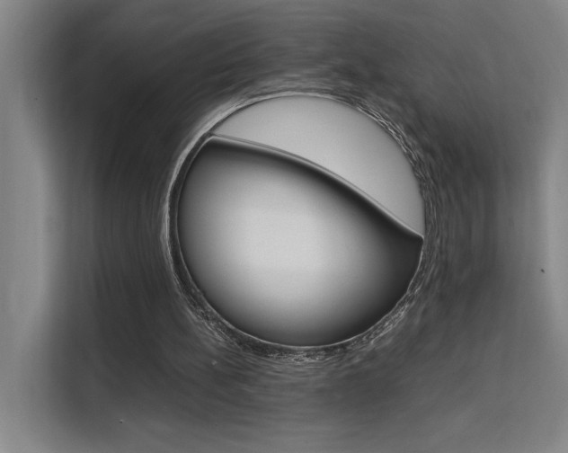 X0000111500148200907141050