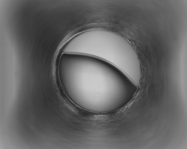 X0000111500150200907141050