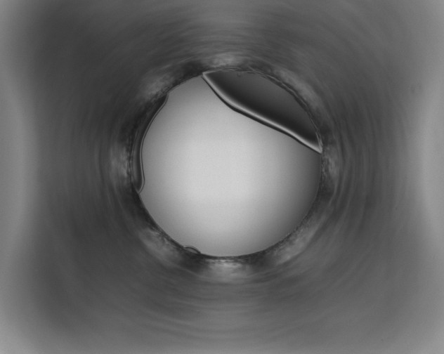 X0000111500380200907141048