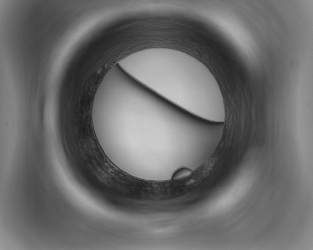 X0000111500383200907141048