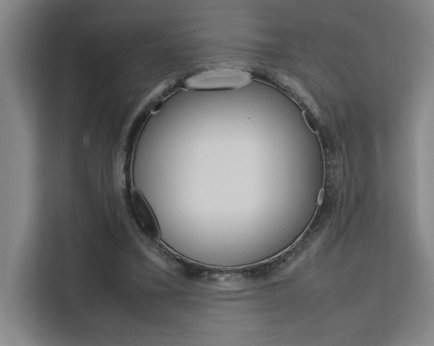 X0000111500395200907141048