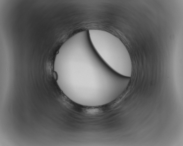 X0000111500669200907141045