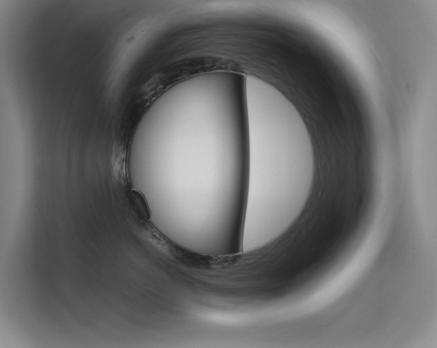 X0000111500766200907141043