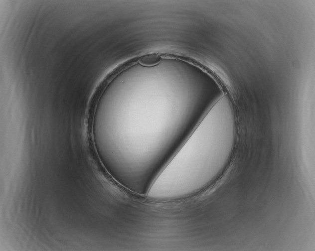 X0000111500880200907141041