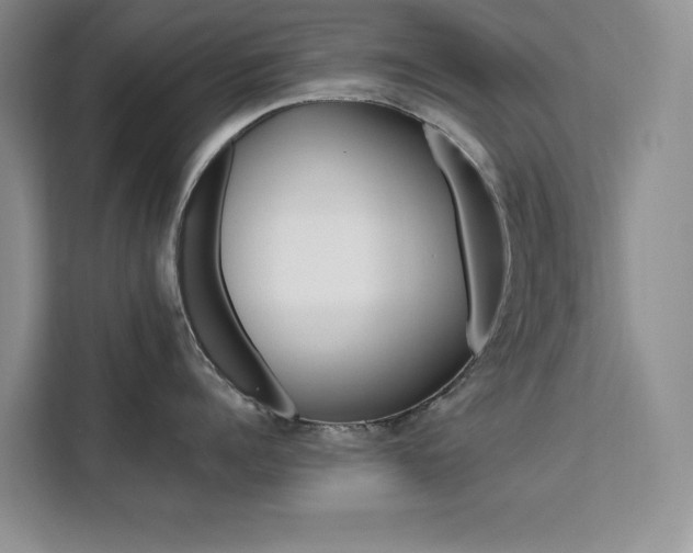 X0000111500960200907141041