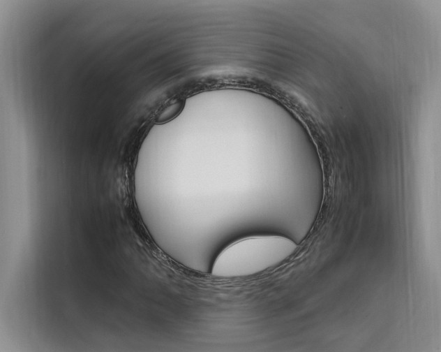 X0000111501062200907141039