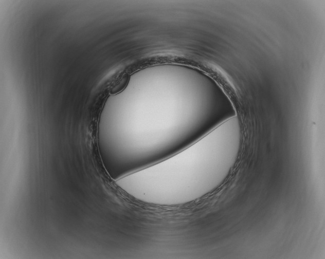 X0000111501064200907141039