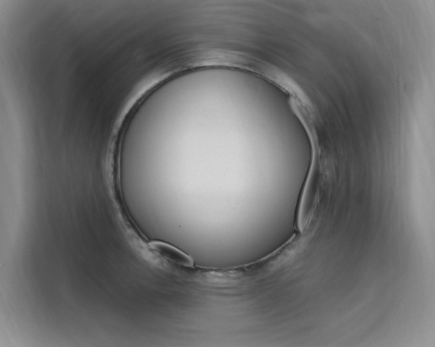 X0000111501138200907141038