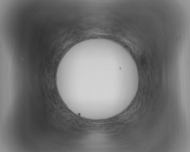 X0000111501157200907141038