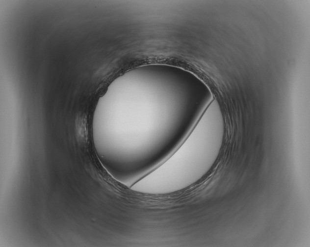 X0000111501252200907141036