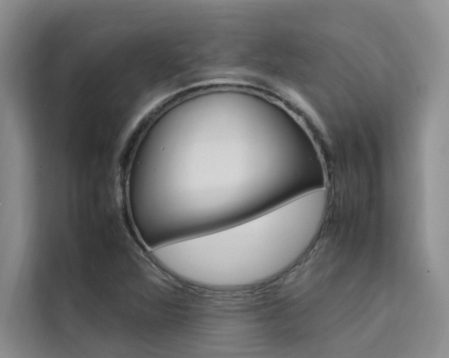 X0000111501360200907141035