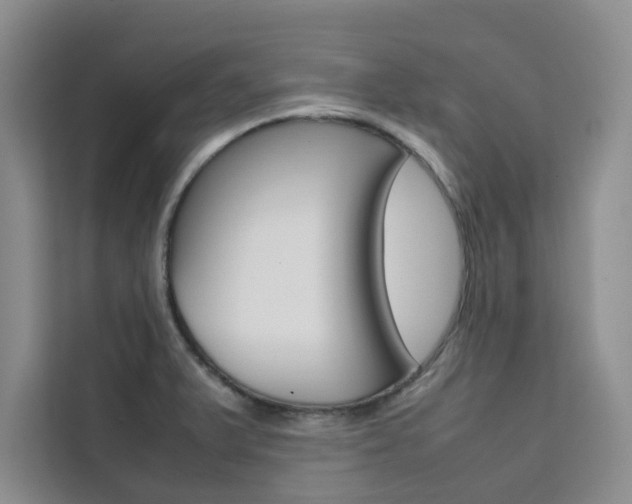 X0000111501375200907141035