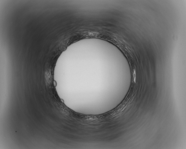 X0000111501395200907141034