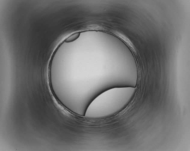 X0000111501439200907141035