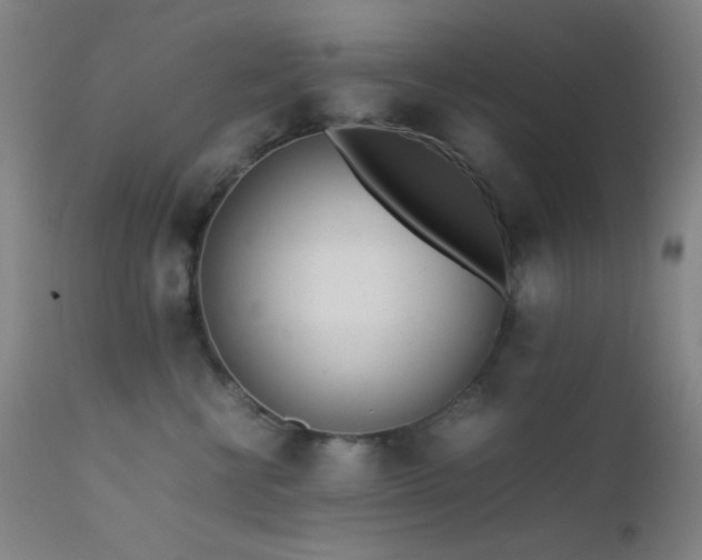 X0000111500570200907141315