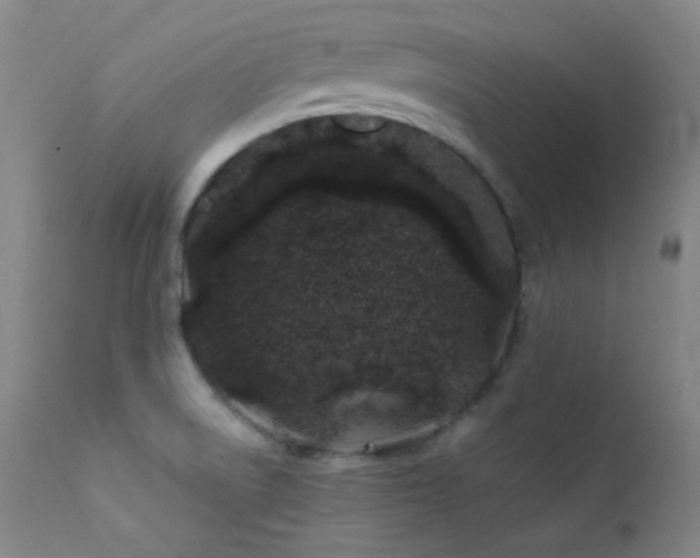 X0000111501522200907141300