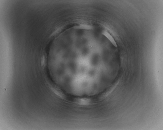 X0000111500165200907211038