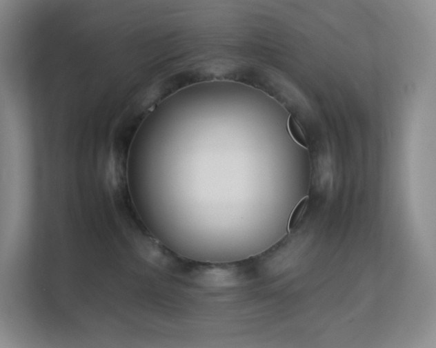 X0000111500236200907211037