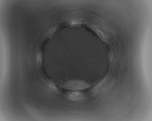 X0000111500475200907211034