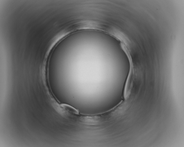 X0000111501138200907211025