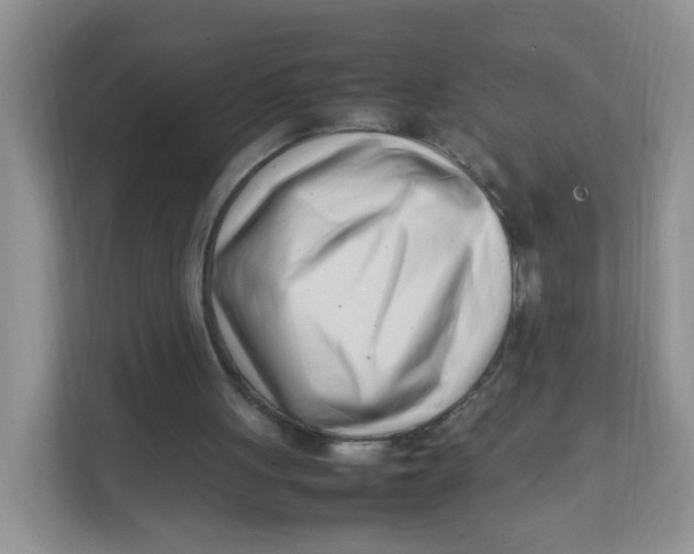 X0000111500051200908041210