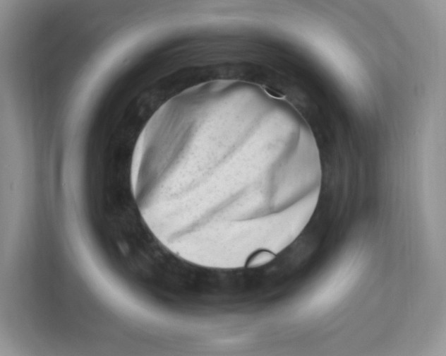 X0000111500383200908041207