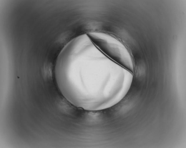 X0000111500570200908041205