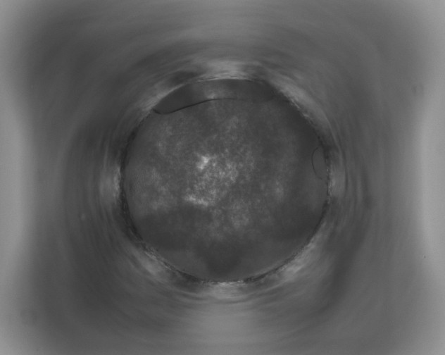 X0000111501161200908041156