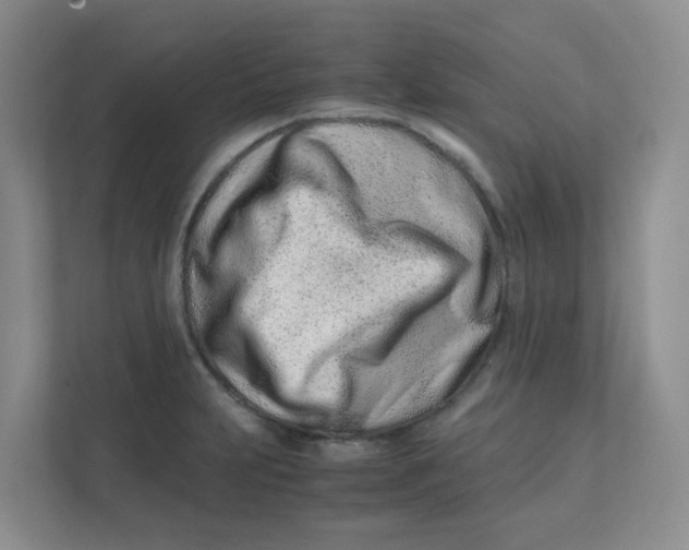 X0000111501231200908041156