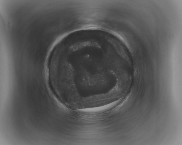 X0000111501414200908041153