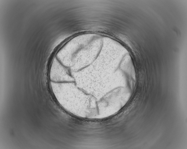 X0000111501071200908111241